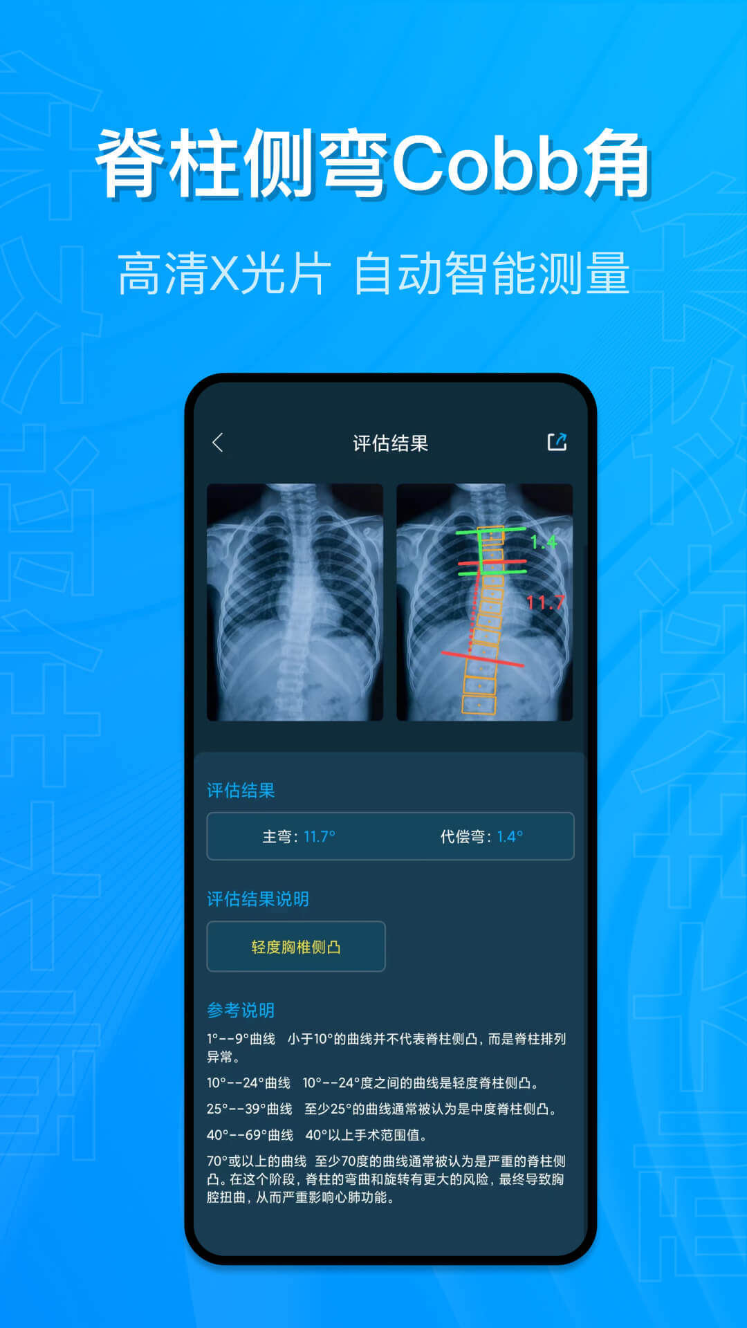 体态评估大师截图