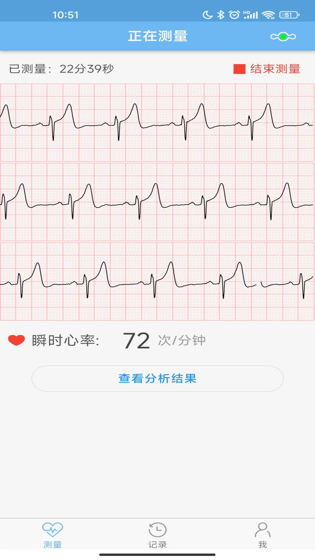 数维康心电