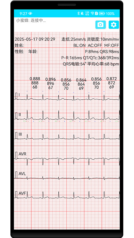 小蜜蜂心电传感器电脑版截图