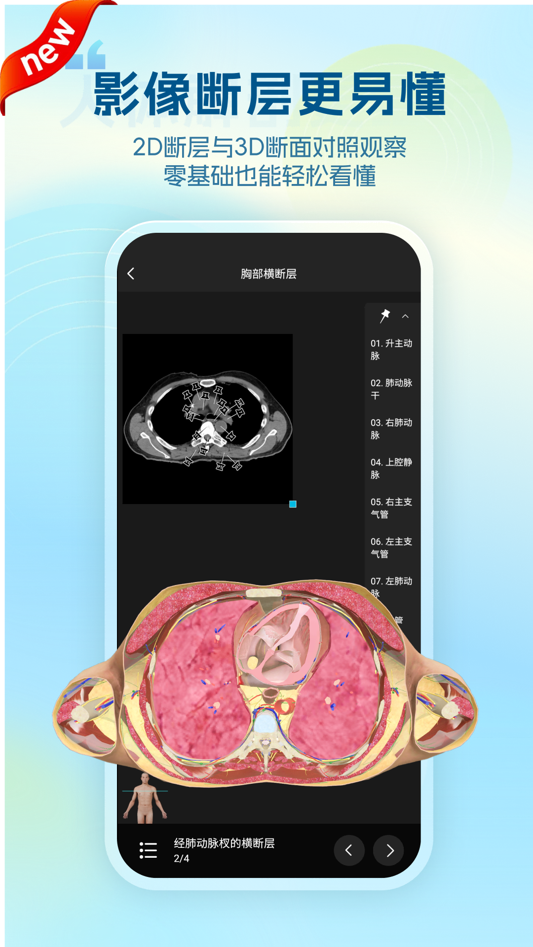 维萨里3D解剖